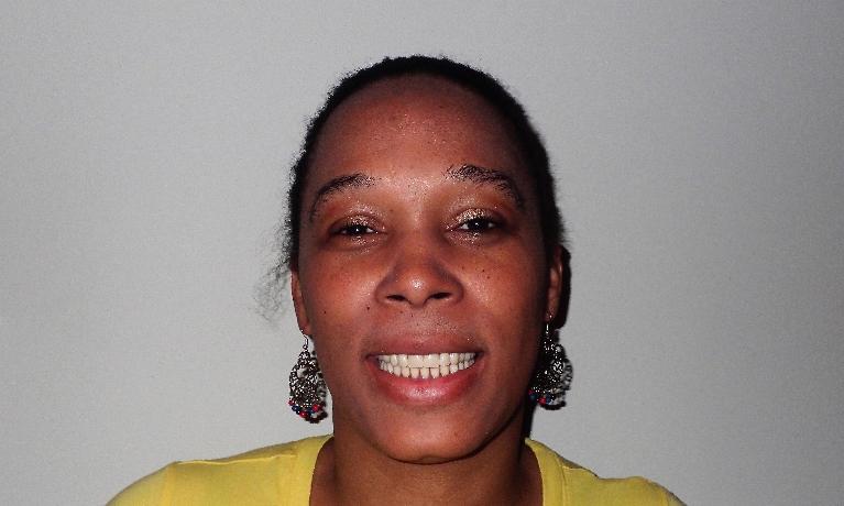 Terry-s-Summer-Smile-After-Image